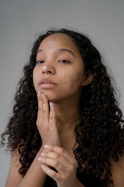 Saiba como disfarcar e, ao mesmo tempo, tratar manchas de acne na pele