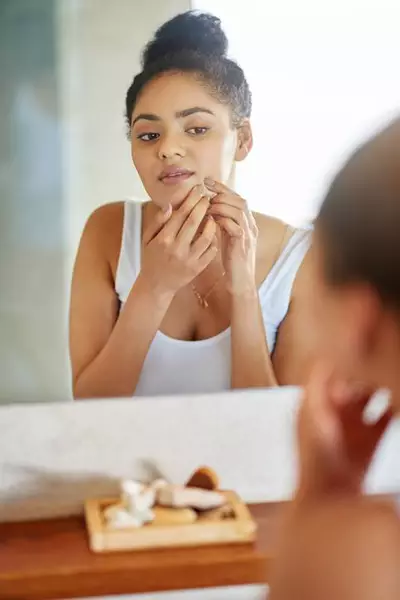 Rosto de mulher com hiperpigmentacao pos-inflamatoria por causa de acne