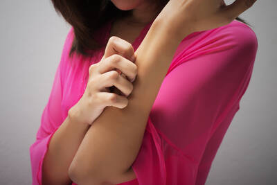 Mulher com urticaria