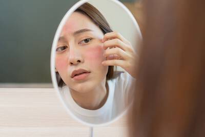 Rosacea e dermatite podem causar mancha vermelha na pele do rosto