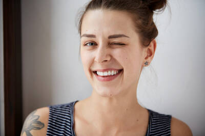 Foto das linhas do sorriso, sulcos ou vincos que aparecem ao redor da boca com o envelhecimento.