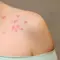 Saiba o que pode ser manchas vermelhas no corpo que cocam e se espalham