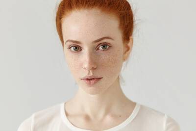 Entenda se a rosacea tem cura e como amenizar as manchas vermelhas