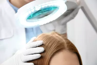 Pessoa com psoriase no couro cabeludo e aplicando tratamento