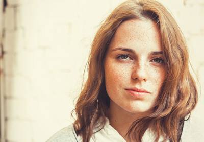Rosto de mulher com manchas escuras na pele, um problema comum do melasma.