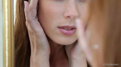 Mulher com olheiras hereditarias