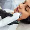 ulher deitada em maca recebendo procedimento de microagulhamento facial com dispositivo profissional, realizado por especialista com luvas pretas.