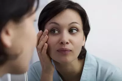 Mulher com rugas ao redor dos olhos, conhecidas como "pes de galinha", e como preveni-las e trata-las.