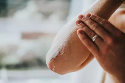 Pele com dermatite atopica no rosto, com informacoes sobre a condicao e como trata-la.