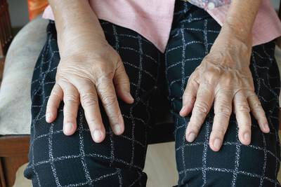 Mulher lidando com inchaco no corpo.