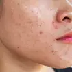 mulher fazendo limpeza de pele