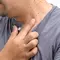 Ceratose Seborreica
