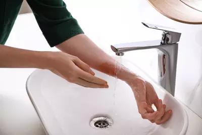 Entenda o que e bom para queimadura - Dermaclub
