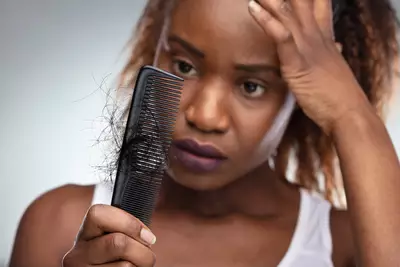 Mulher negra segurando pente de cabelo, que possui muitos fios soltos preso nele, com rosto de preocupada pela queda de cabelo excessiva.