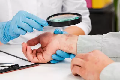 Infeccao de pele: saiba o que e e como cuidar - Dermaclub