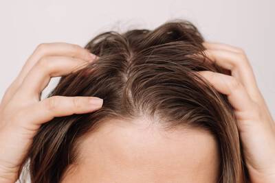 Mulher com oleosidade do cabelo representando necessidade do shampoo para cabelos oleosos