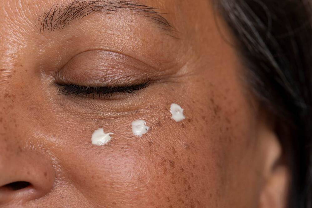 Mulher com vitamina c na area dos olhos