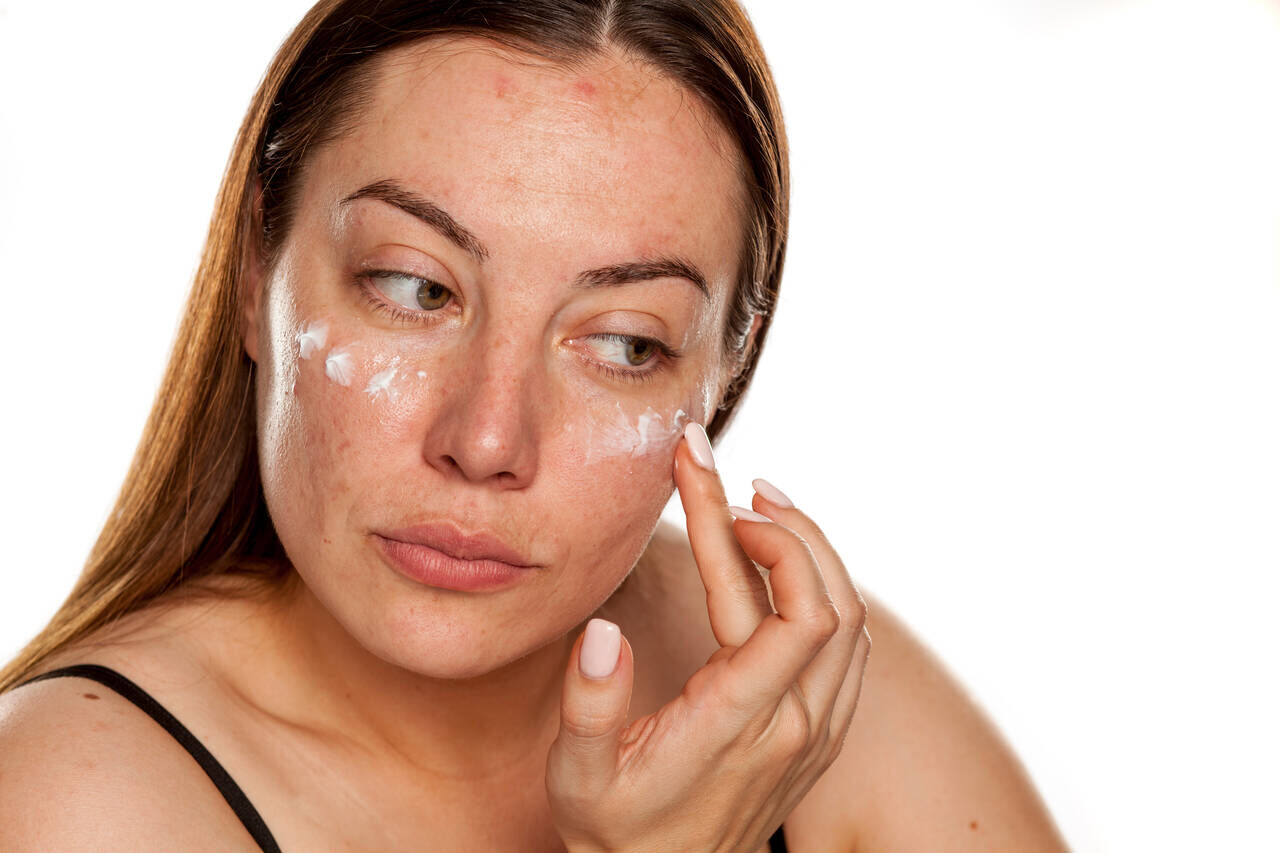 Mulher aplicando creme para manchas no rosto