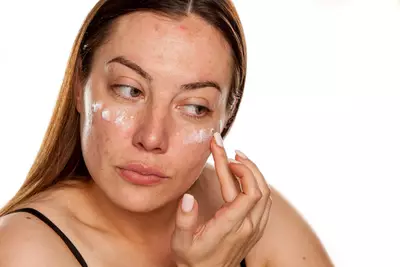 Mulher aplicando creme para manchas no rosto