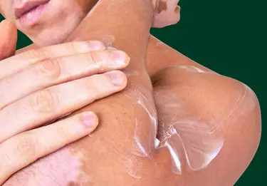Homem com manchas na pele