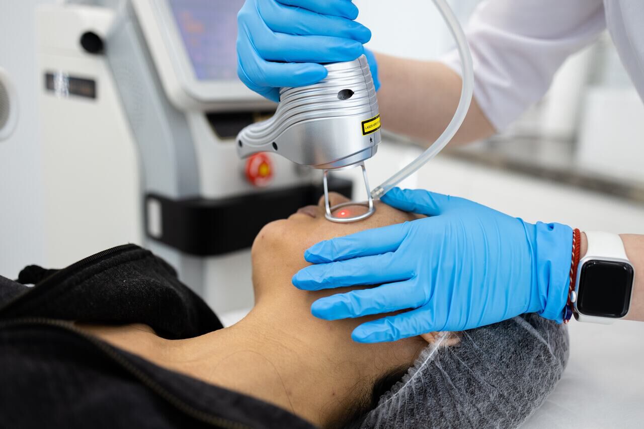 Pessoa fazendo a aplicacao do laser no procedimento Black Peel.