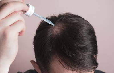 Homem usando minoxidil no cabelo