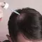 Homem usando minoxidil no cabelo