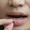 Pessoa com labios ressecados