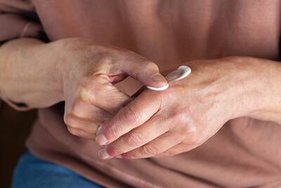 Mulher passando pomada para dermatite atopica