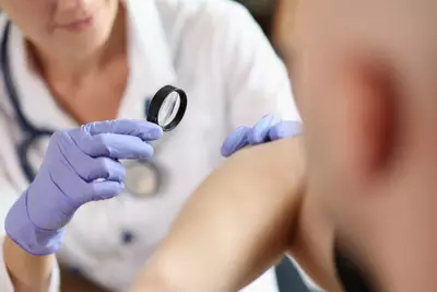 Dermatologista examinando sinais de diabetes na pele