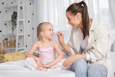 Mulher cuidando de crianca com varicela (catapora)