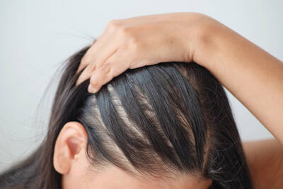 O que e bom para queda de cabelo feminino?