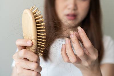 Mulher com queda de cabelo