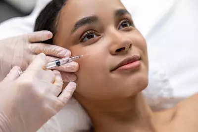 Mulher jovem deitada enquanto uma outra pessoa, com luvas transparentes de latex, aplica uma seringa de toxina botulinica em seu rosto.