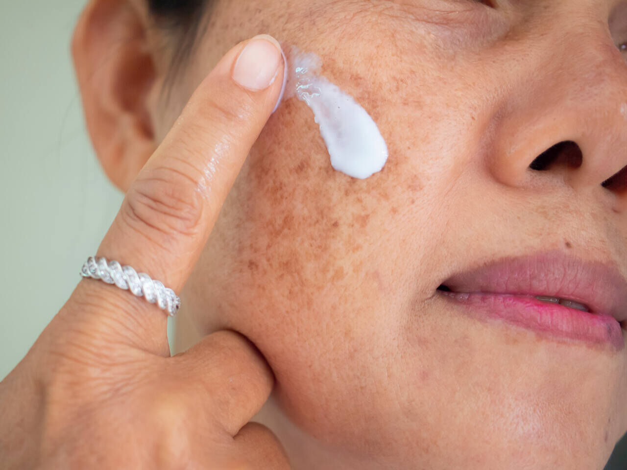 Mulher aplicando melhor pomada para melasma no rosto