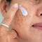 Mulher aplicando melhor pomada para melasma no rosto