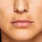 Mulher com manchas na pele