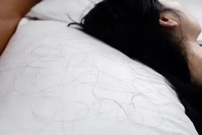 Entenda quais vitaminas ajudam a diminuir a queda de cabelo