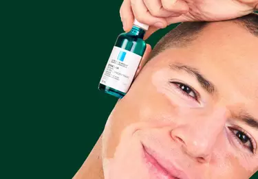 Homem com Effaclar e manchas na pele