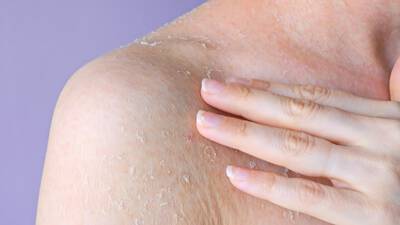 Mulher cuidando da pele no inverno, com dicas para manter a hidratacao e prevenir o ressecamento durante a estacao.