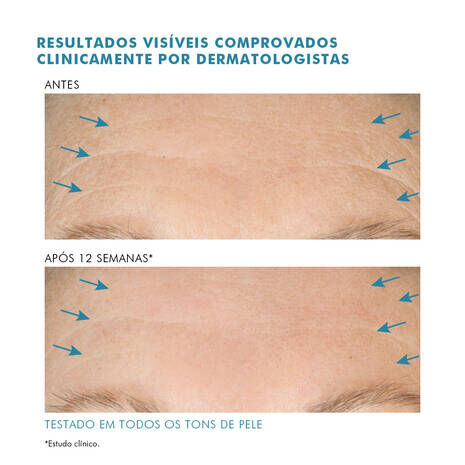 A.G.E. Interrupter Advanced Anti-idade de Alta Potencia
