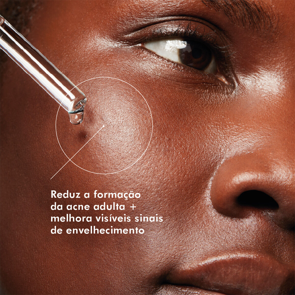 Reduzir acne com Blemish + AGE Defense Tripla Acao