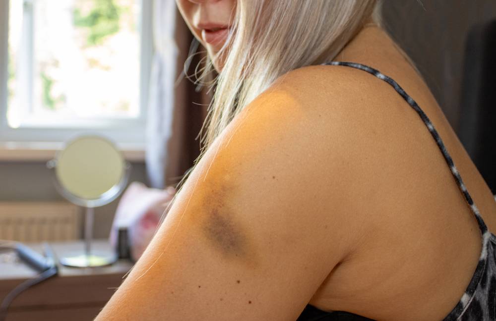 Manchas roxas no corpo: causas e quando se preocupar