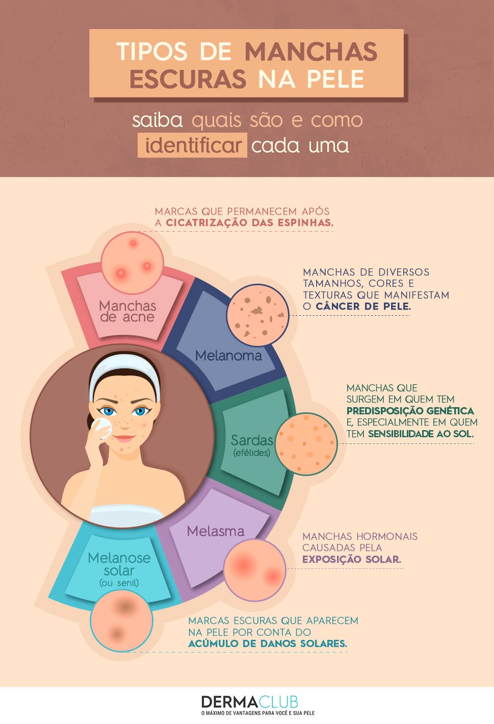 Infográfico com diferentes tipos de manchas escuras na pele do rosto, como melasma e hiperpigmentação.