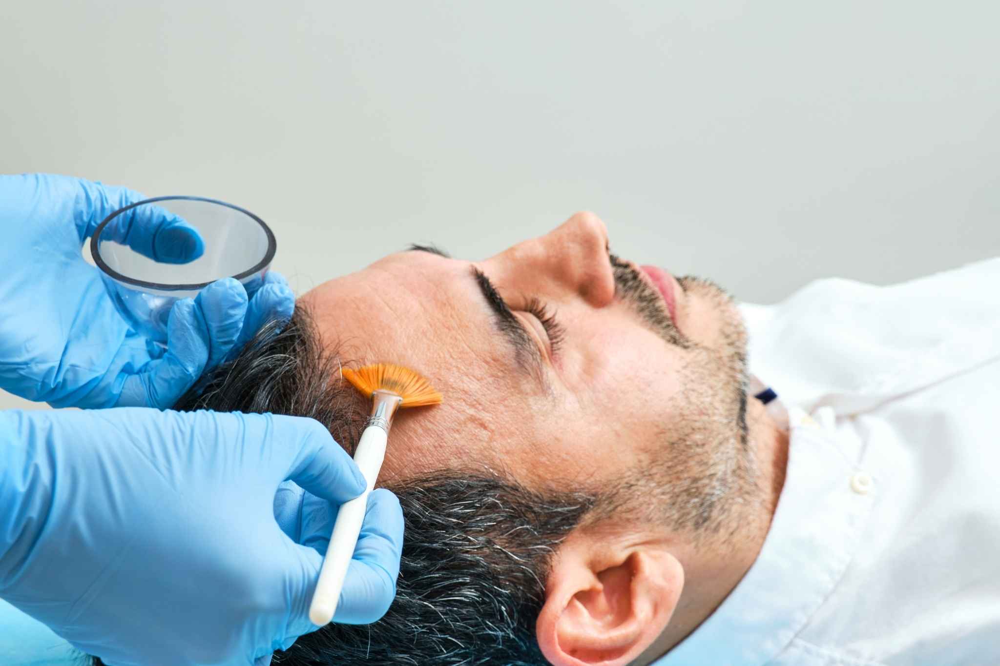 Foto de aplicação de peeling químico em pessoa deitada, procedimento ideal para os cuidados com a pele no inverno visando resultados para o Projeto Verão