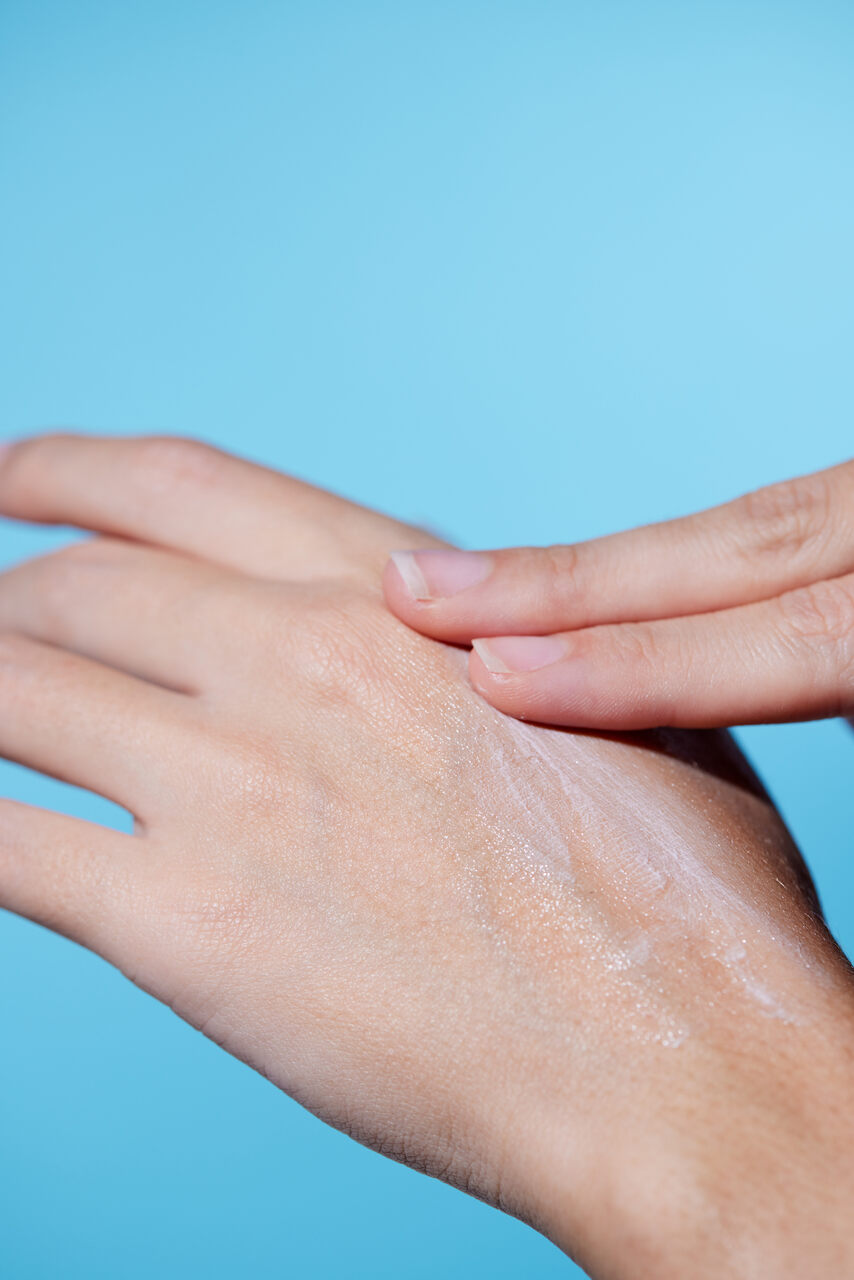 prevenir o descascamento das mãos prevenir o descascamento das mãos