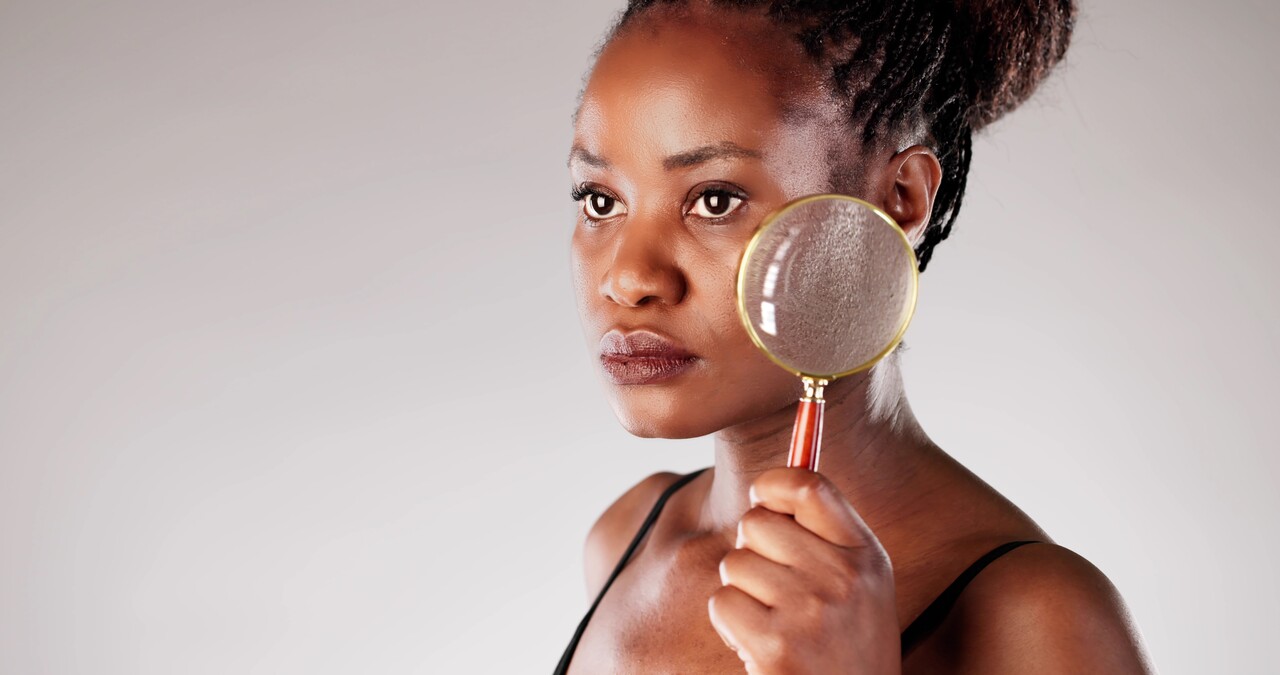 Mulher com lupa mostrando rosácea na pele negra