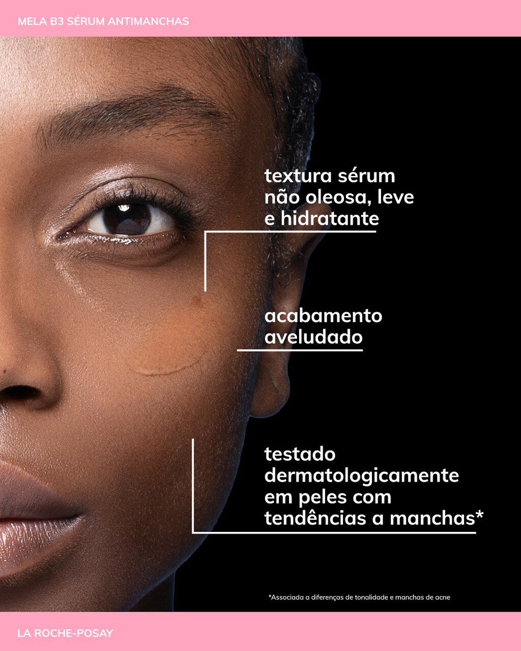 sérum facial antimarcas para pele oleosas