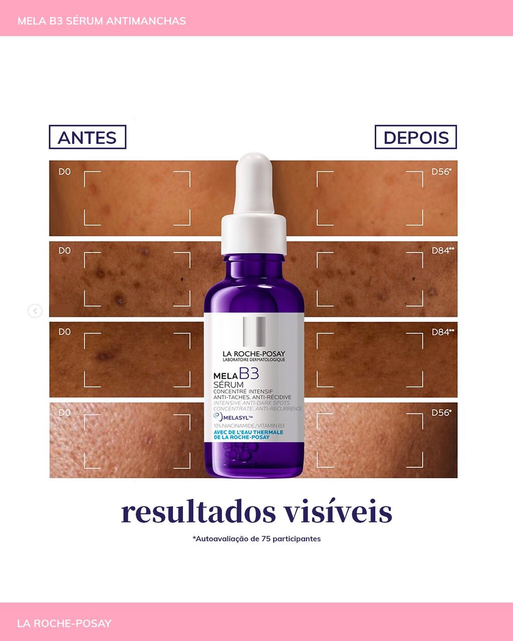 Resultados Visíveis de Mela B3 da La Roche-Posay 
