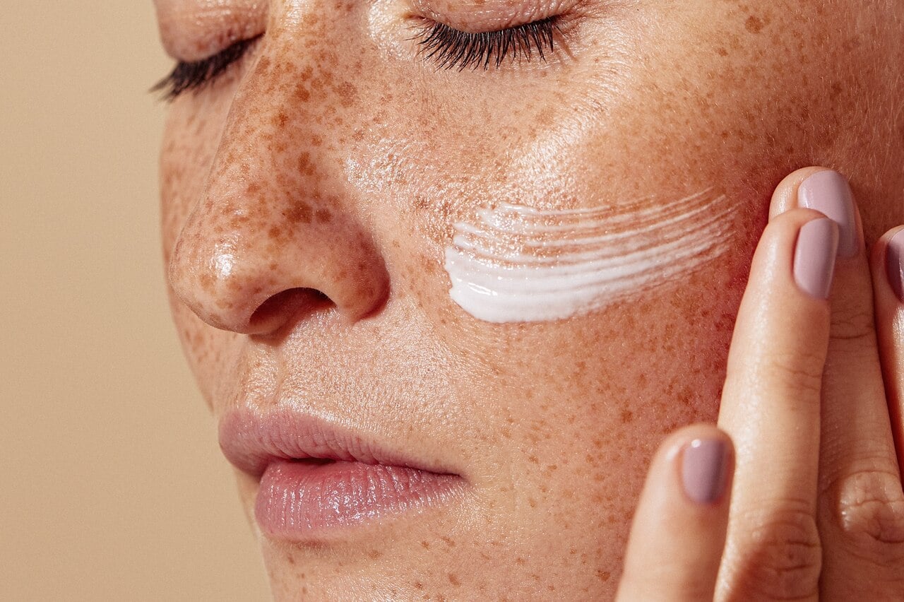 fotos de cloasma Close de mulher com muitas sardas e pele oleosa aplicando hidratante facial com ácido hialurônico.